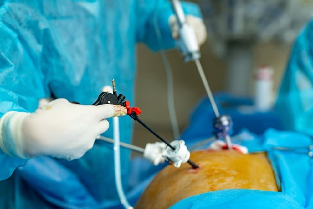 Cirugía endoscópica urológica avanzada